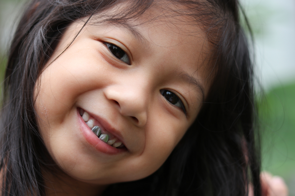 stainless steel dental crowns for children