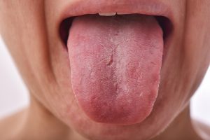 close up of tongue