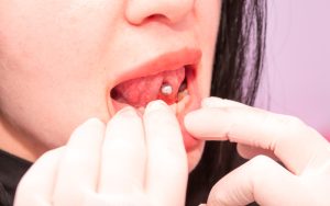 oral piercings and your teeth