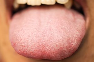 supertaster tongue