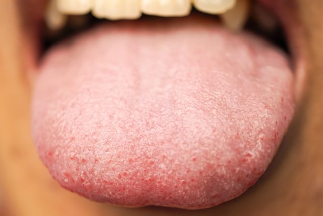 close up of tongue