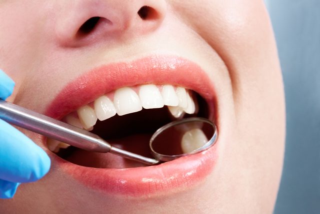 close up of mouth at dentist