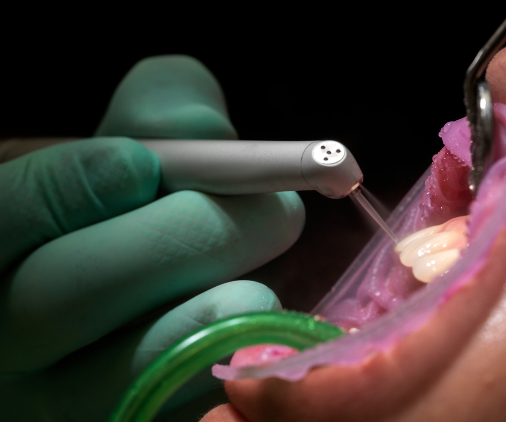 waterlase dentistry