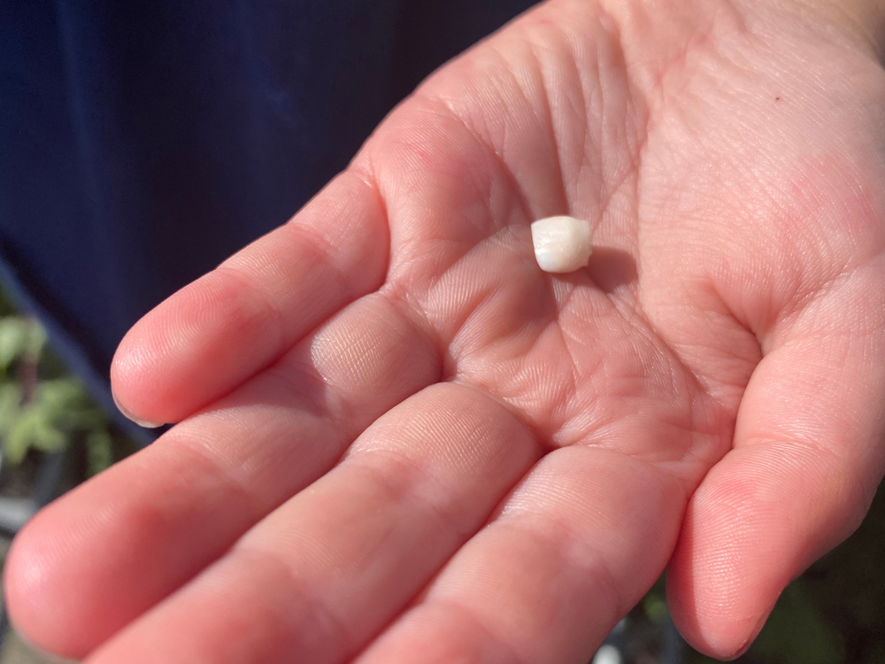 knocked out tooth